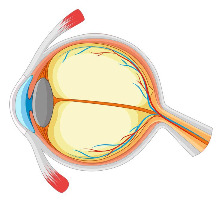 Glaucoma​